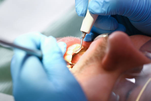 Best Emergency Dental Surgery in Kemp, TX