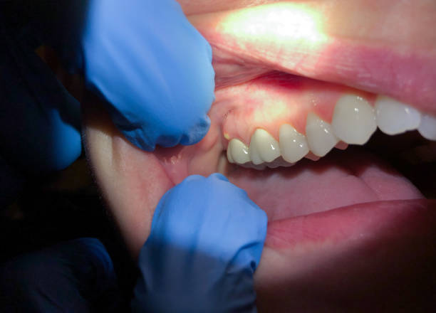 Best Walk-In Emergency Dentist in Kemp, TX