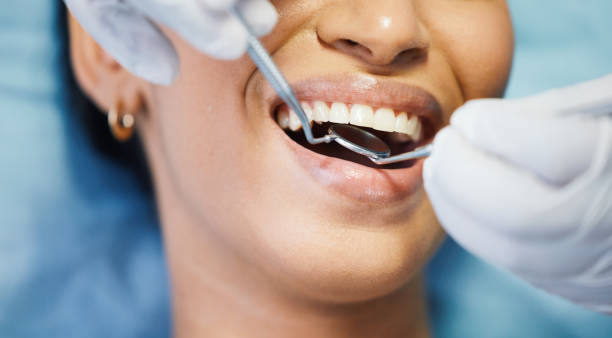 Best Emergency Broken Tooth Repair in Kemp, TX